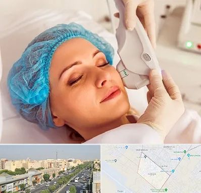 اکسنت در کیانمهر کرج