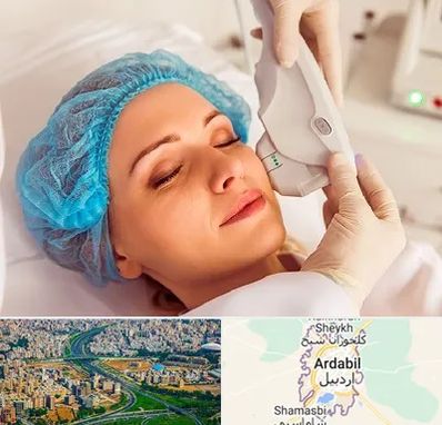 اکسنت در اردبیل