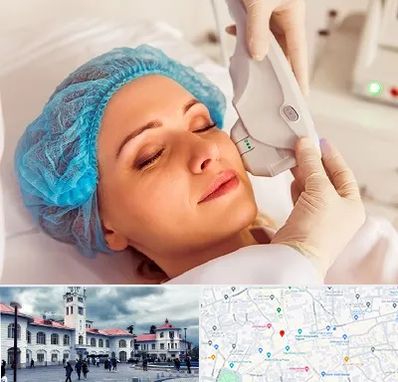 اکسنت در میدان شهرداری رشت