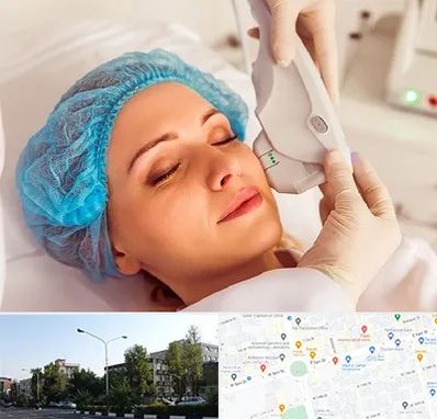 اکسنت در میدان کاج 