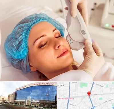 اکسنت در نصف راه تبریز