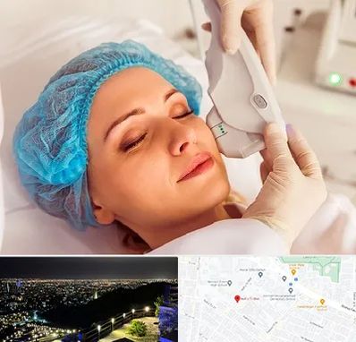 اکسنت در هفت تیر مشهد 