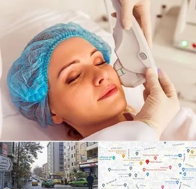 اکسنت در فاطمی 