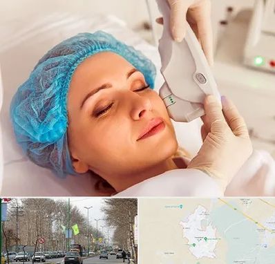 اکسنت در نظرآباد کرج 