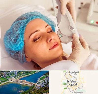 اکسنت در اصفهان