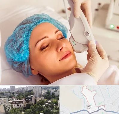 اکسنت در اوین