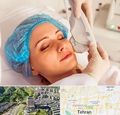 اکسنت در شمال تهران 