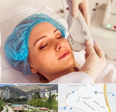 اکسنت در شهر زیبا 