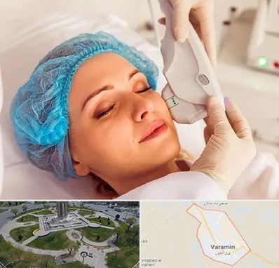 اکسنت در ورامین