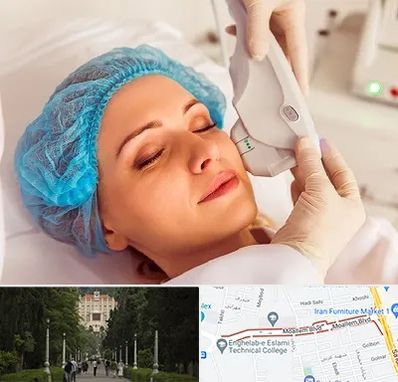 اکسنت در بلوار معلم رشت 