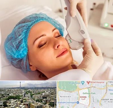 اکسنت در گیشا 