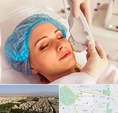 اکسنت در نازی آباد 