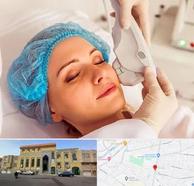 اکسنت در زنبیل آباد قم