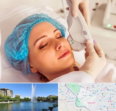 اکسنت در کوهسنگی مشهد