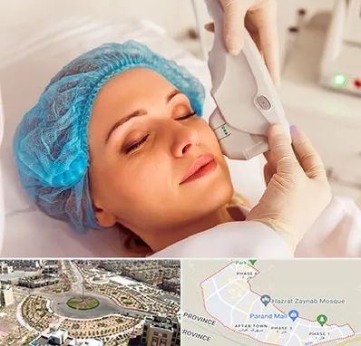 اکسنت در پرند