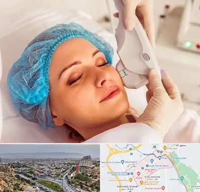 اکسنت در معالی آباد شیراز