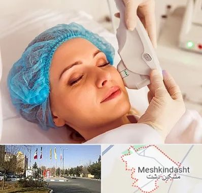 اکسنت در مشکین دشت