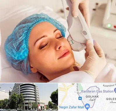 اکسنت در قلهک 