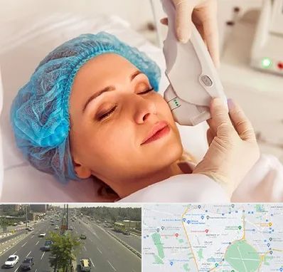 اکسنت در منطقه 17 تهران 