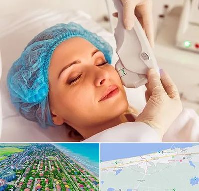 اکسنت در فریدونکنار