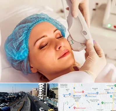 اکسنت در پیروزی 