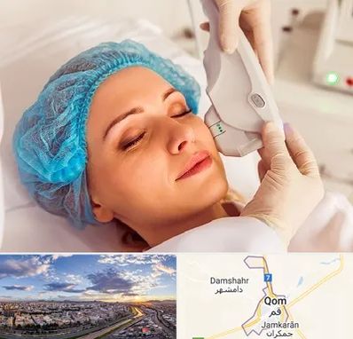 اکسنت در قم