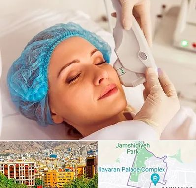 اکسنت در نیاوران 