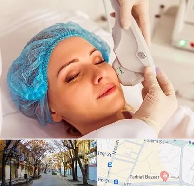 اکسنت در تربیت تبریز