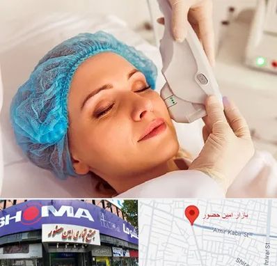 اکسنت در امین حضور