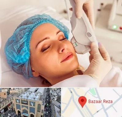 اکسنت در بازار رضا مشهد