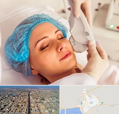 اکسنت در بندر ماهشهر