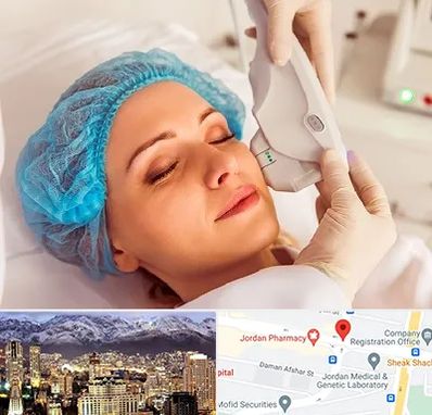 اکسنت در جردن 