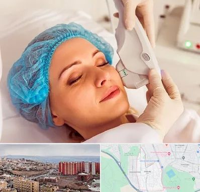 اکسنت در سهند تبریز