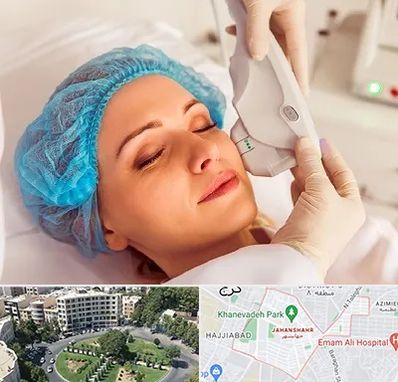 اکسنت در جهانشهر کرج 