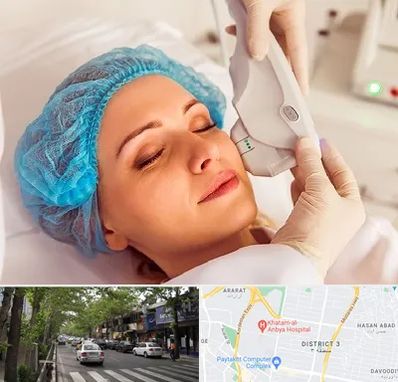 اکسنت در ظفر 