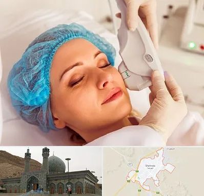 اکسنت در شهرضا