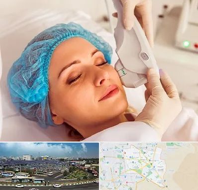 اکسنت در منطقه 15 تهران 