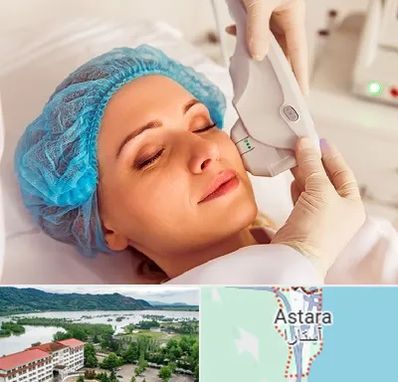 اکسنت در آستارا