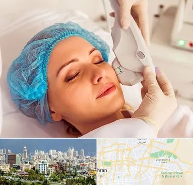 اکسنت در شرق تهران 