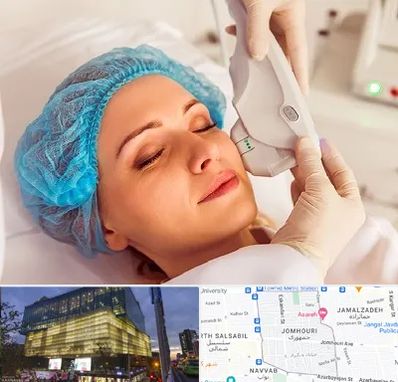 اکسنت در جمهوری 