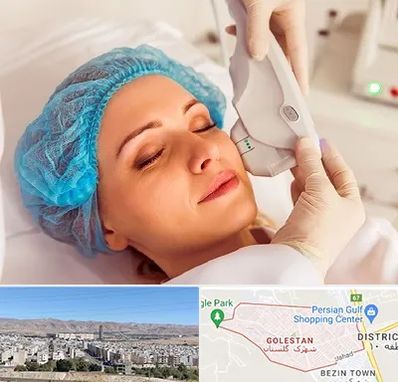 اکسنت در شهرک گلستان شیراز