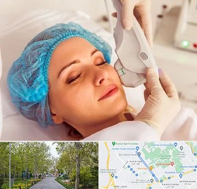 اکسنت در قدوسی غربی شیراز