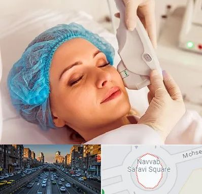 اکسنت در نواب