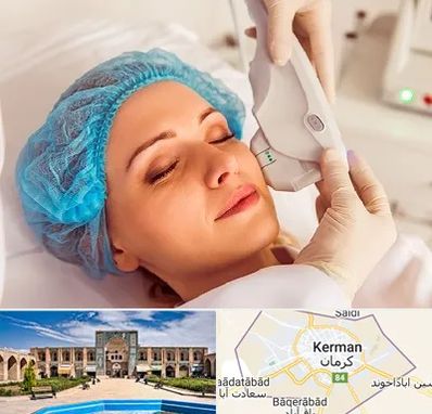 اکسنت در کرمان