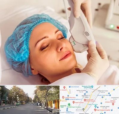 اکسنت در شریعتی 