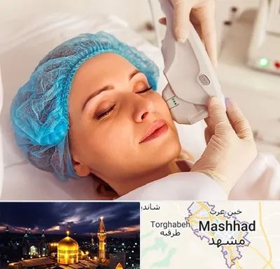 اکسنت در مشهد