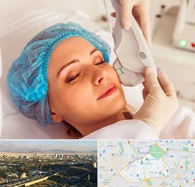 اکسنت در منطقه 19 تهران 