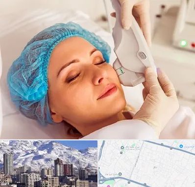 اکسنت در ازگل