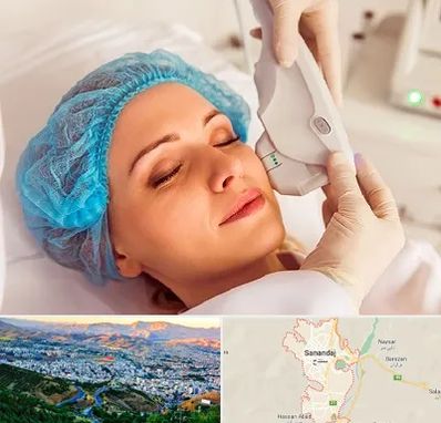 اکسنت در سنندج