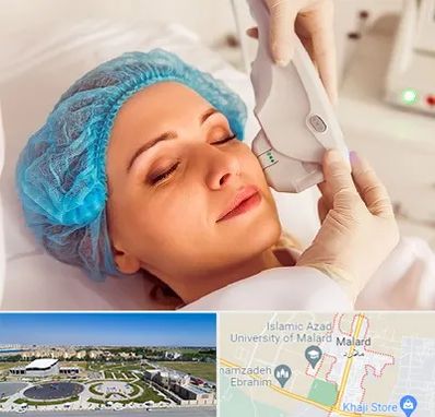 اکسنت در ملارد